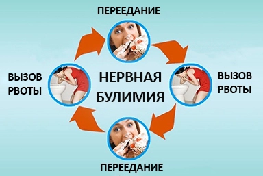 Лечение булимии в Тигиле